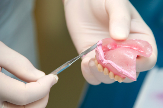 implant dentaire à l'étranger