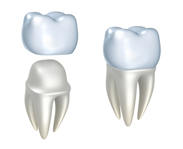 Eurodentiste - facettes dentaires à Belgrade